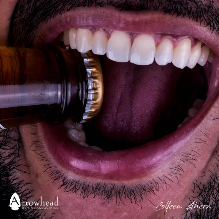 Is Alcohol Bad for Teeth?