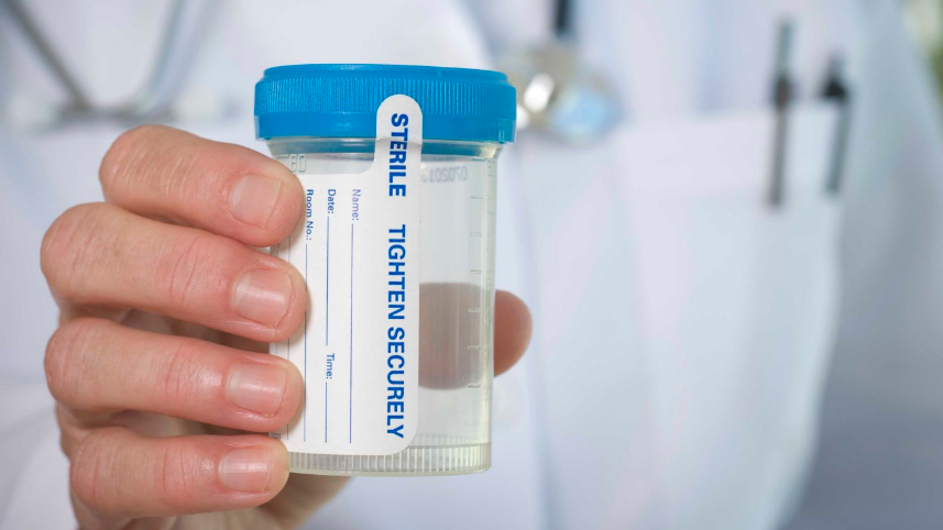 What Panel Drug Test Does Probation Use