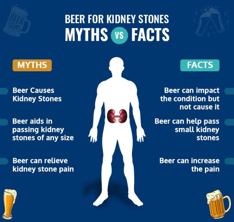 Is Alcohol Bad for Kidney Stones?