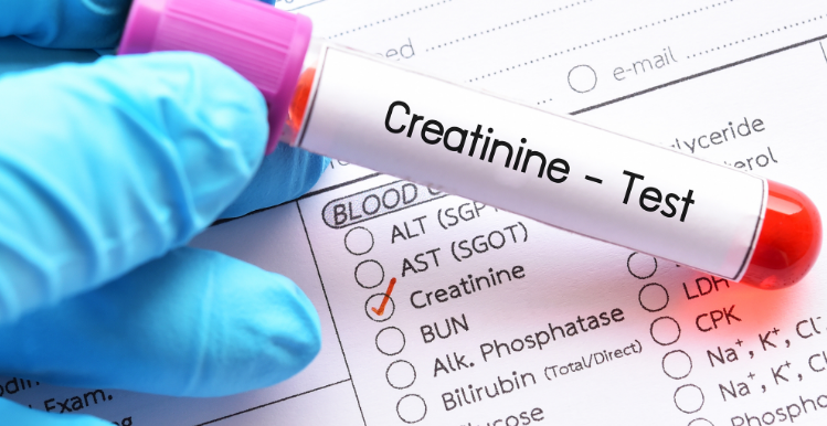 What Causes High Creatinine Levels in Urine Drug Test?