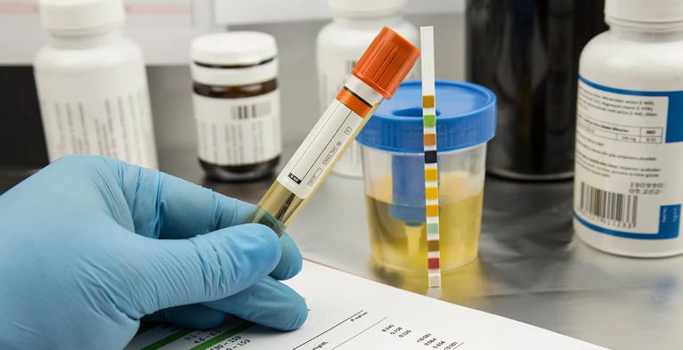 What Does Mro Stand for in Drug Testing